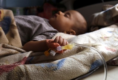 Kolera Vakası Artıyor Açıklaması 872 Bin Kişi !