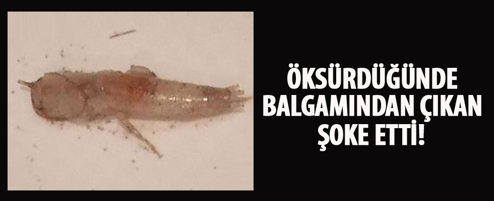 Öksürdüğünde balgamından çıktı!