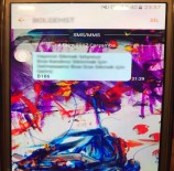 MÜSTEHCEN - Özel Hastaneden Ahlak Dışı SMS Şoku