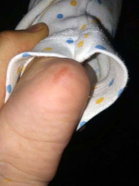 Babanın çocuğunun üzerinde sigara söndürdüğü iddiası