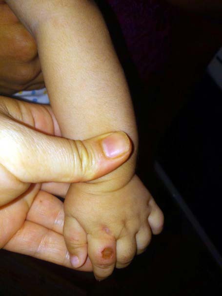 Babanın çocuğunun üzerinde sigara söndürdüğü iddiası