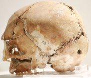 MUSTAFA DOĞAN - 11 Bin Yıl Önce İlk Beyin Ameliyatının Yapıldığı Aşıklıhöyük Tarihe Işık Tutuyor
