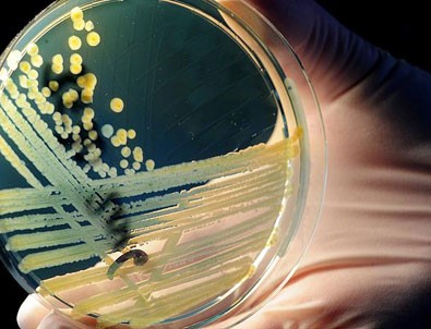 Hastalıklı dokuları aydınlatan nano-bileşke üretildi