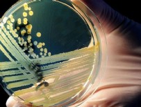 NANO - Hastalıklı dokuları aydınlatan nano-bileşke üretildi