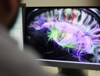 ETHAN - Beynin elektrik bağlantılarının haritası çıkarıldı