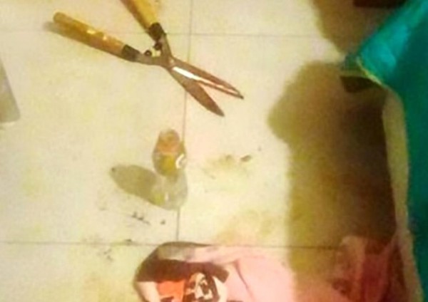 Arjantin'de uyuyan sevgilisinin cinsel organını kesti