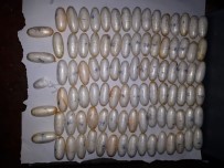 RÖNTGEN - Midesinden 95 Kapsül Kokain Çıktı