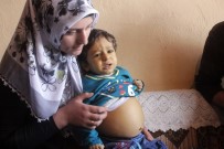 KARACİĞER YETMEZLİĞİ - Minik Şerzan Nakil Bekliyor