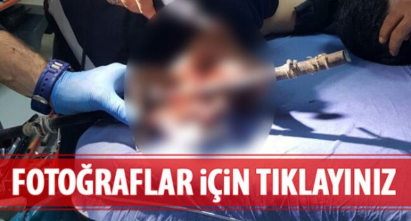 İtfaiye erleri ameliyata girdi