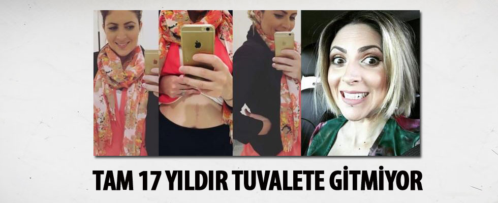 17 yıldır tuvalete gitmiyor