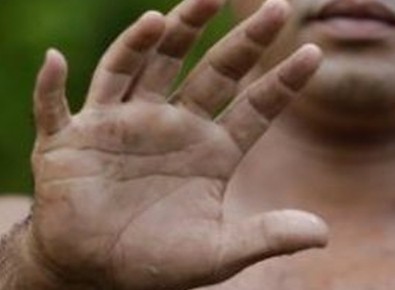 Bu köyde insanlar '6 parmaklı' doğuyor!