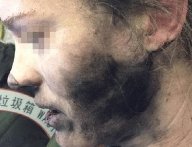 Pilli kulaklık bu hale getirdi