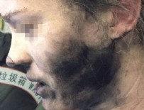 Pilli kulaklık bu hale getirdi