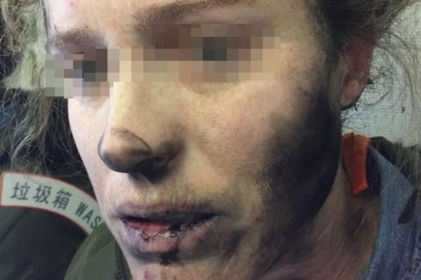 Pilli kulaklık bu hale getirdi