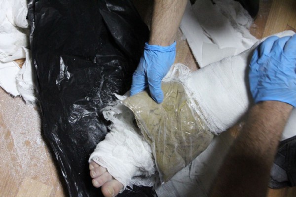 Ayağındaki alçıda esrar bulundu