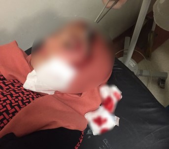 AK Parti'li Kadınlara Taşlı Saldırı Açıklaması 2 Yaralı