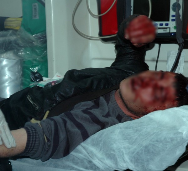 Hırsızın acı sonu