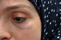 BAŞÖRTÜLÜ - Almanya'da 3 Türk Kadınına Saldırı