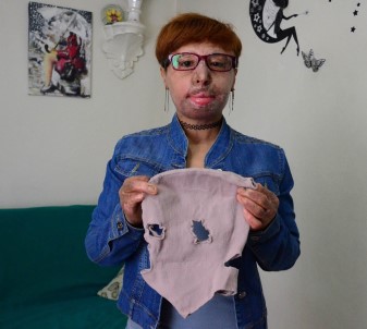 5 yıl sonra maskesini çıkardı