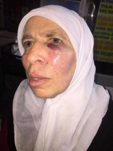 İzmir'de Yaşlı Kadın Acımasızca Yumruklandı