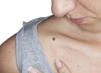 BENIN - 'Ben'lere dikkat