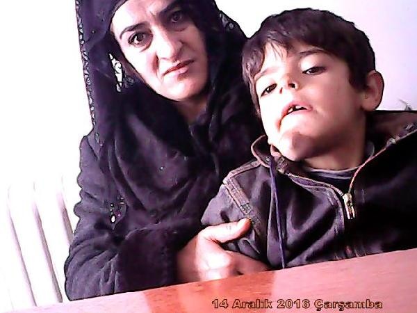 Çenesindeki tümöre 7 yaşına kadar kimse müdahale edememişti!