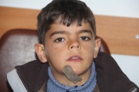 TÜMÖRLÜ KİTLE - Çenesindeki tümöre 7 yaşına kadar kimse müdahale edememişti!