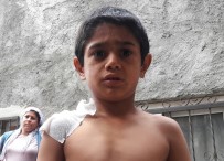 FAST FOOD - Sıcak Suyla Saldırılan Minik Çocuk Konuştu