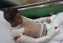 Samsun'da Çakmak Gazı Parladı Açıklaması 4 Çocuk Yaralı