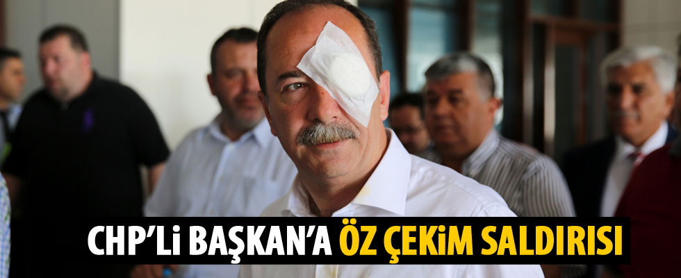 Belediye başkanına yumruklu saldırı