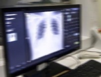 COLUMBIA ÜNIVERSITESI - Akciğerin özelliklerini taklit eden organoidler geliştirildi