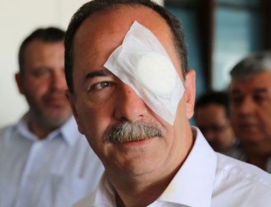 Edirne Belediye Başkanı'na saldırıda flaş gelişme