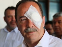 RECEP GÜRKAN - Edirne Belediye Başkanı'na saldırıda flaş gelişme