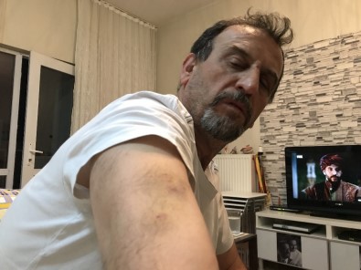 'Engelli Yoluna Park Etme' Dediği İçin Linç Edildi..