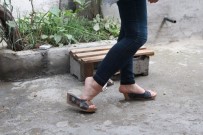 AYAK PARMAKLARI - Ayak Parmakları Üzerinde Yürüyen Genç Kız Tedavi Edilmek İstiyor