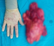 VARİS - Bacağından öyle bir şey çıktı ki...