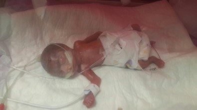 560 Gram Doğan Erva Bebek 4 Ay Sonra Taburcu Oldu