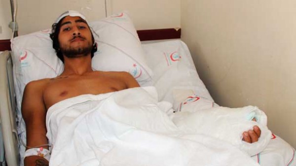 Kazada eli koptu! Otostoptan sonrasını hatırlamıyorum...