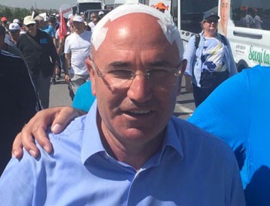 Mahmut Tanal sakatlandı