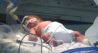 SÜLEYMAN DEMIREL ÜNIVERSITESI - Annesi Öldürülen Bebeğin Hayati Tehlikesi Sürüyor