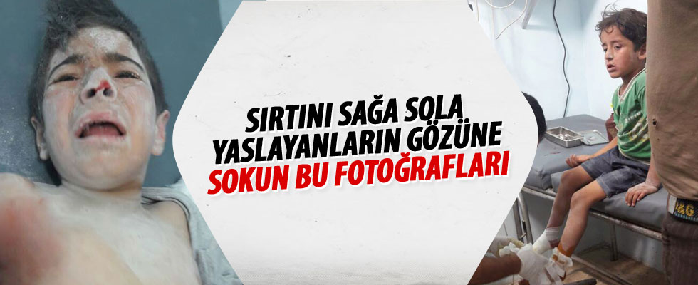 PKK/PYD'den sivillere saldırı