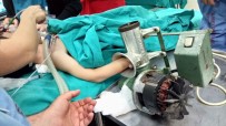 KIYMA MAKİNESİ - Elini Kaptırdığı Kıyma Makinesiyle Hastaneye Kaldırıldı