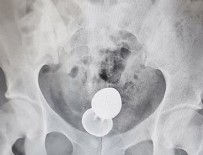 DAILY MAIL - Fantezi hastanede son buldu!