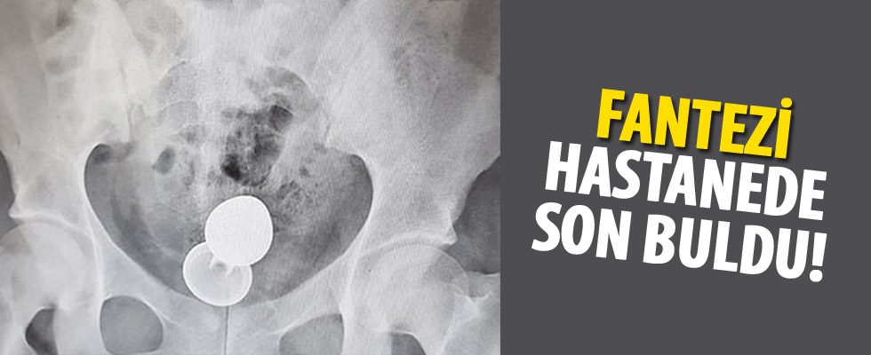 Fantezi hastanede son buldu!