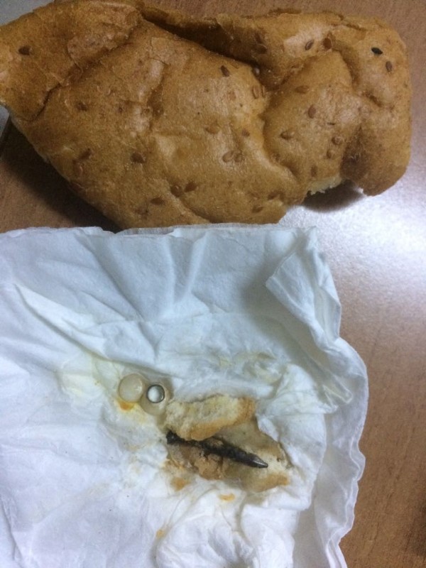 Pideden çıkan çivi 4 dişini kırdı!