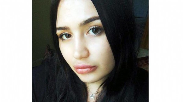 Silikon mağduru hemşirenin son hali