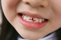 DİŞ TEDAVİSİ - 'Diş Ayrıklığı 16 Yaş Sonrasında Anormal'