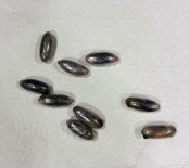 RÖNTGEN - Faslı Kuryenin Midesinden 102 Kapsül Esrar Çıktı