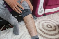 AĞRI KESİCİ - Ağrı'da Kuduz Köpek Dehşeti Açıklaması 1 Ölü