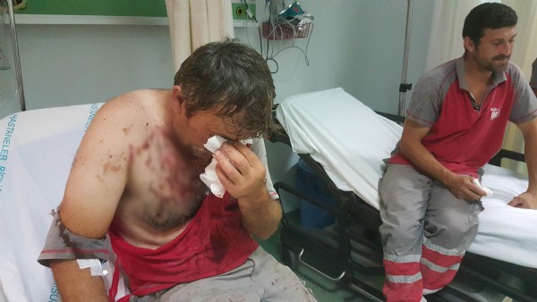 İnşaat işçilerinin kavgasında 4 kişi hastanelik oldu